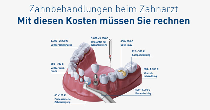 DFV Zahnarzt Kosten Übersicht